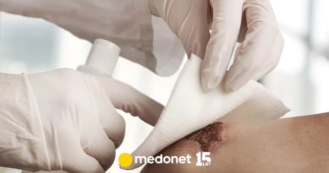 Dezynfekcja jakie ma znaczenie dla zdrowia i bezpieczeństwa w czasach pandemii